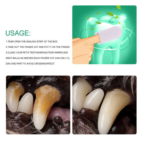 Finger Sleeve Tooth Cleaner — 20-Pack